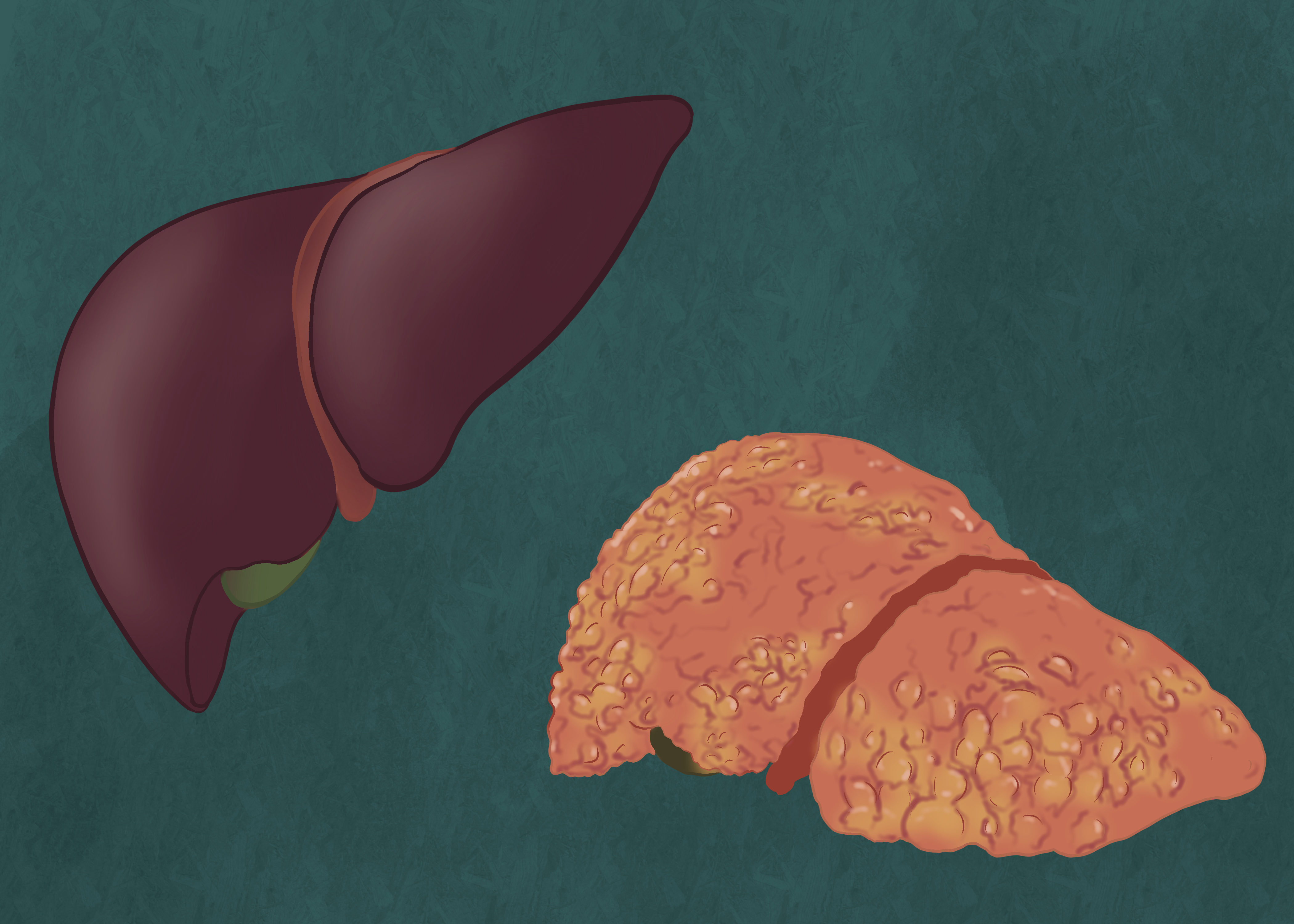 RT_Liver_Gillich_24_04_10