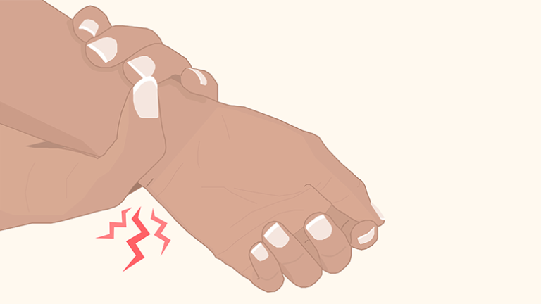 Preventing rheumatoid arthritis