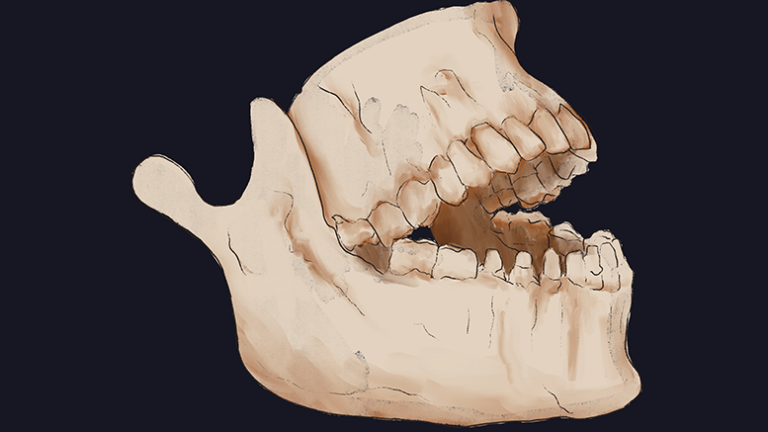 Using dental anthropology to understand humanity