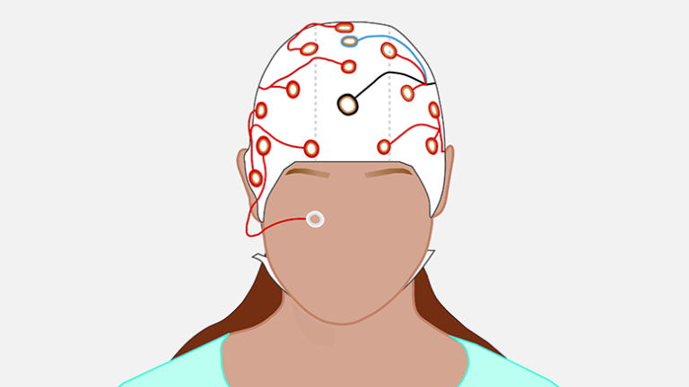 Commemorating 100 years of EEG in cognitive sciences