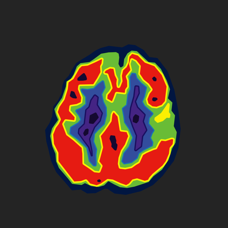 The science behind nuclear medicine