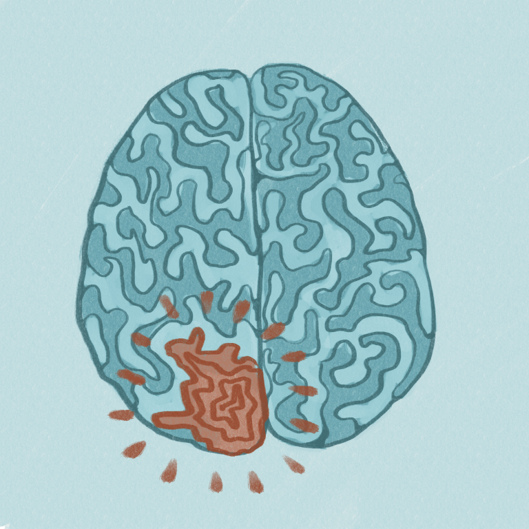 Inside the brain cancer battle
